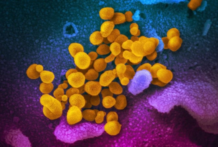 electron microscope image, U.S. National Institutes of Health, Novel Coronavirus SARS-CoV-2, 