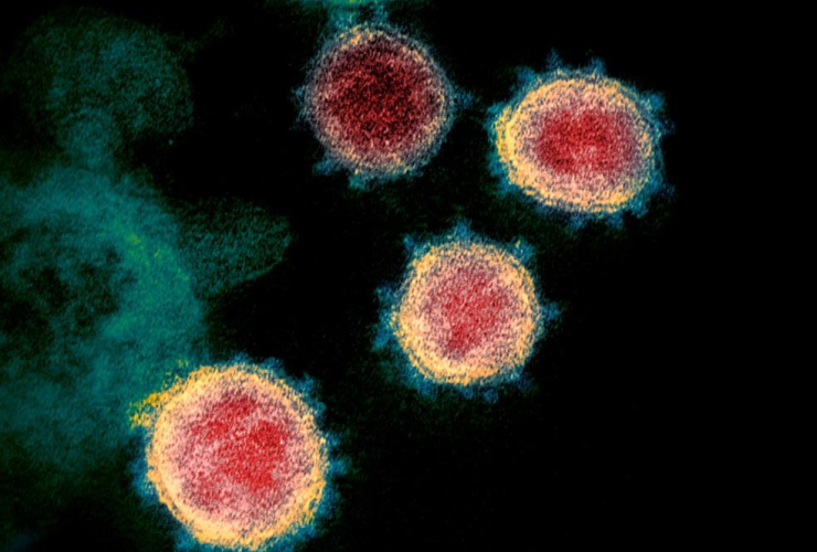 electron microscope image, U.S. National Institutes of Health, virus, COVID-19, novel coronavirus, HIV, 