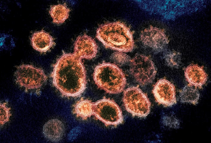 SARS-CoV-2 virus particles,